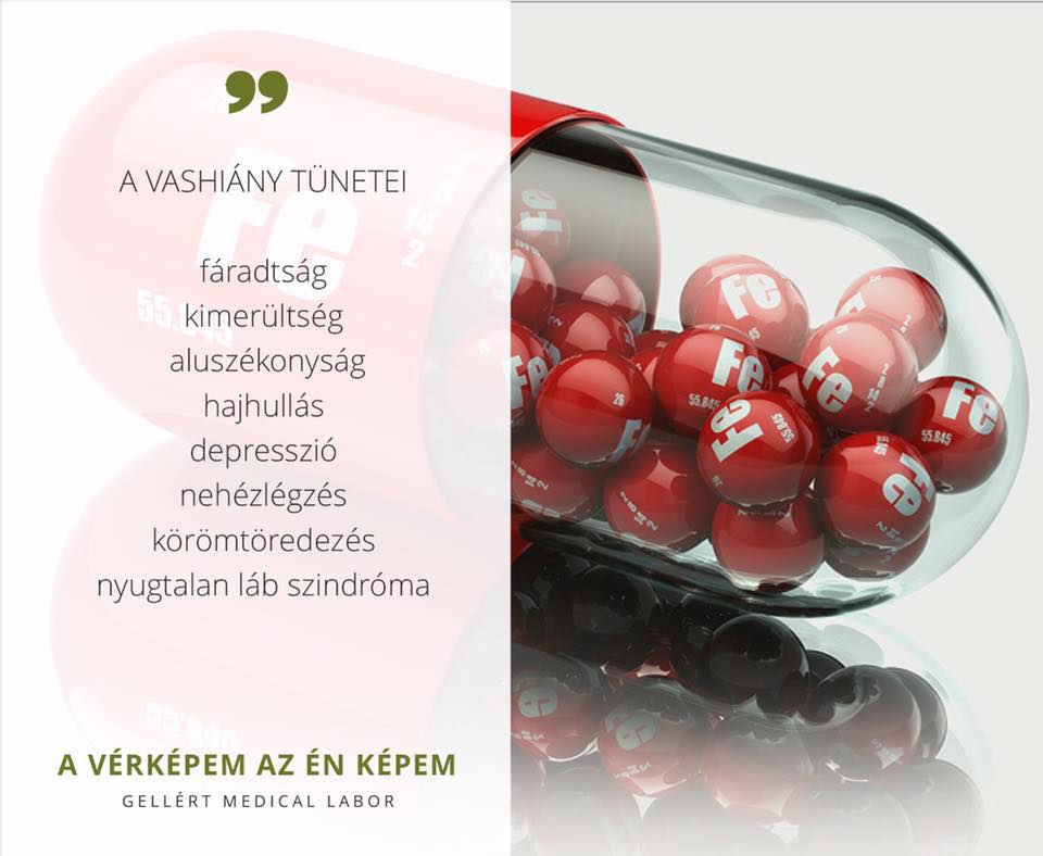 
<span>A vashiányos állapotoknál nem elegendő csak a vas szintet ellenőrizni. </span>
