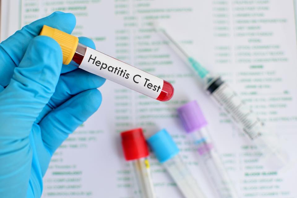 
<span>Egyre több a Hepatitis C-vel fertőzött </span>
