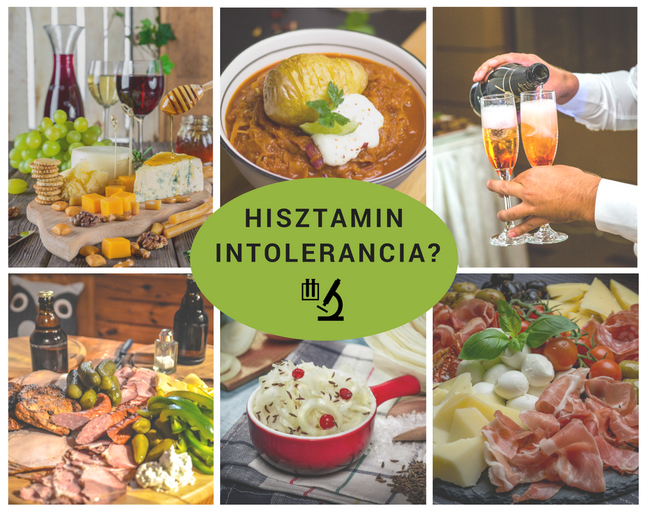 
<span>Mi az a hisztamin intolerancia?</span>
