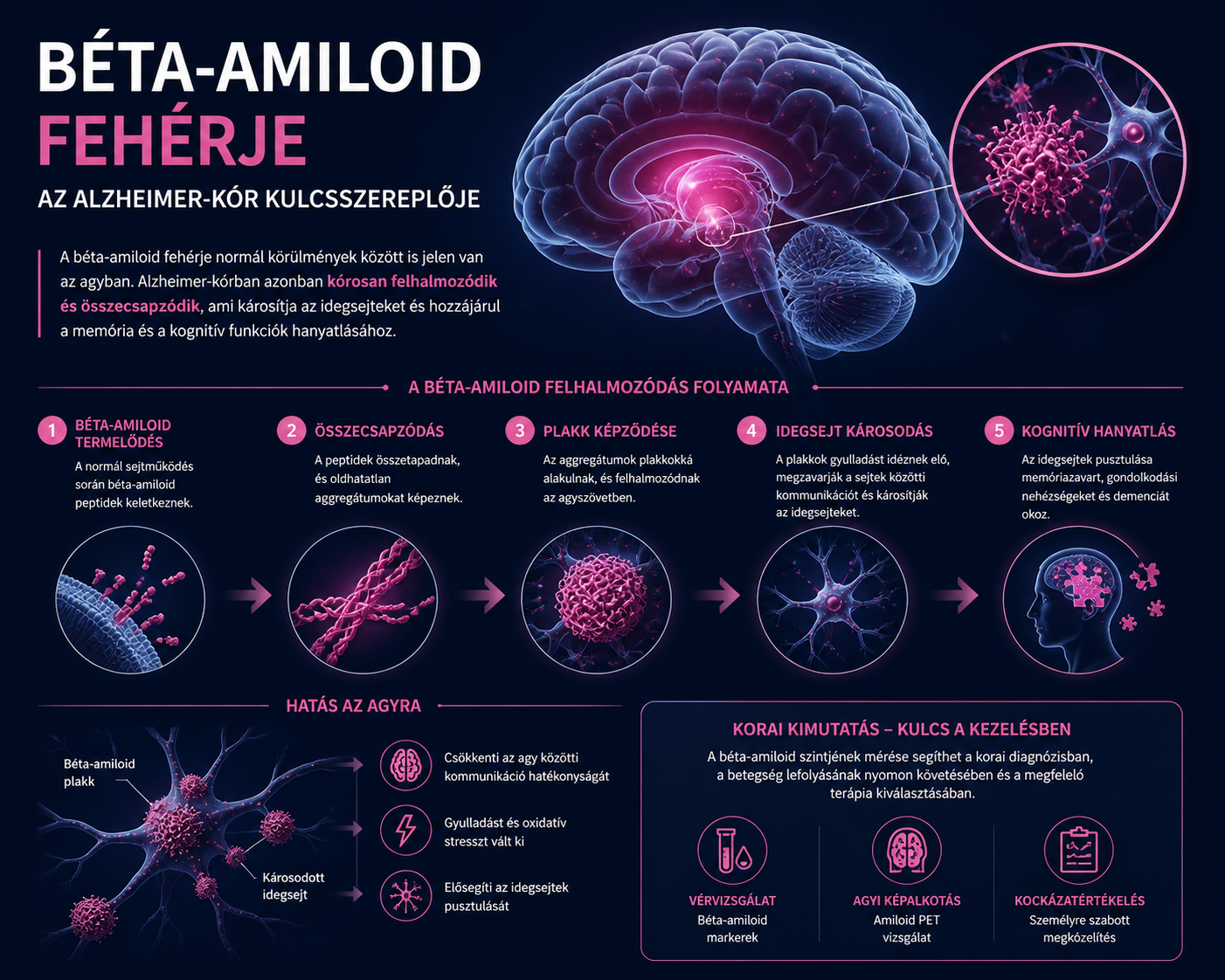 Hogyan kapcsolódik a béta-amiloid az Alzheimer-kórhoz?