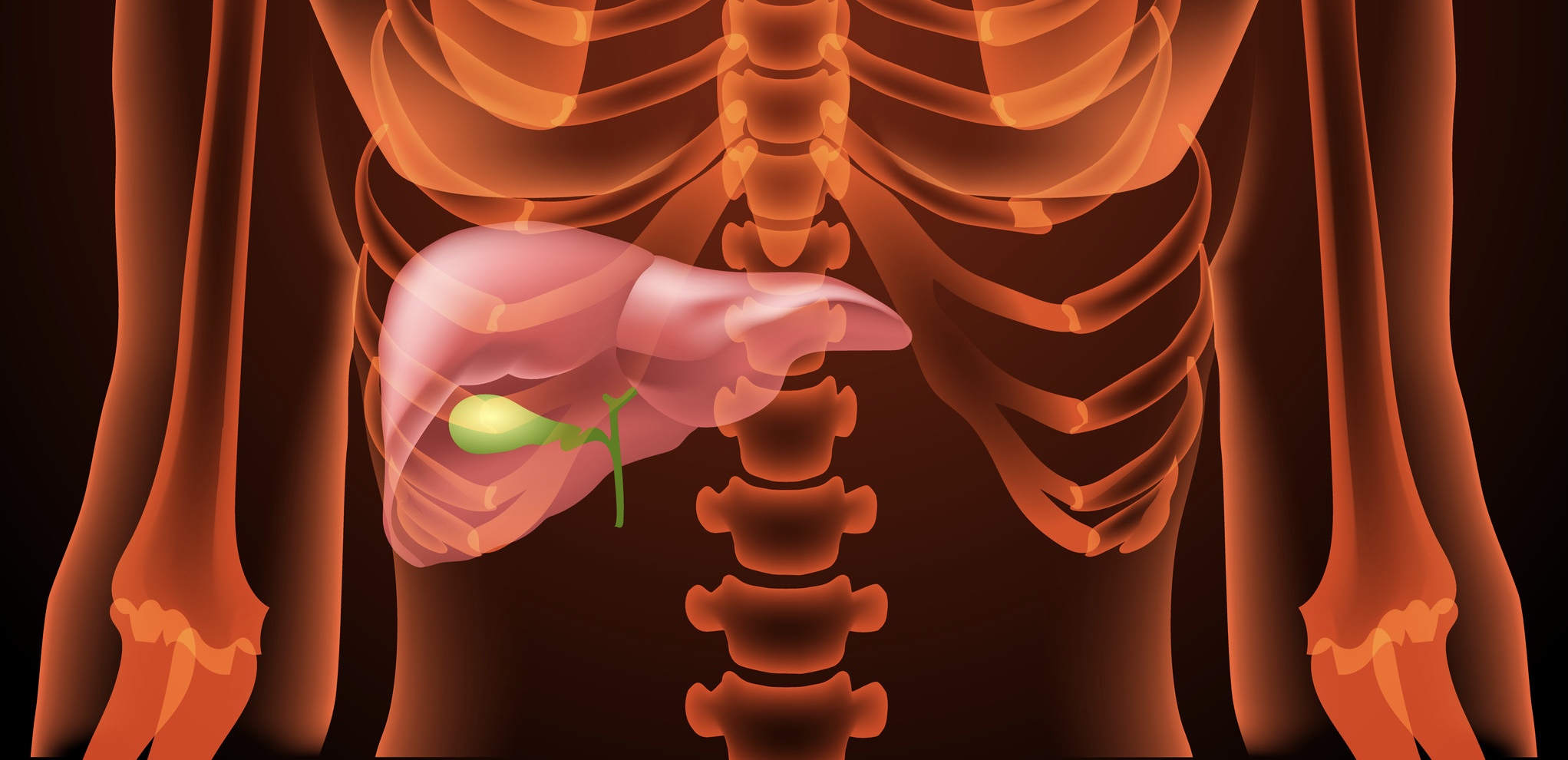 Primer biliaris cirrhosis (PBC)