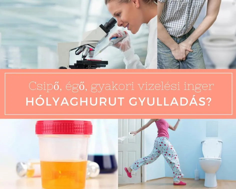 A heveny hólyaggyulladás előfordulása és okai