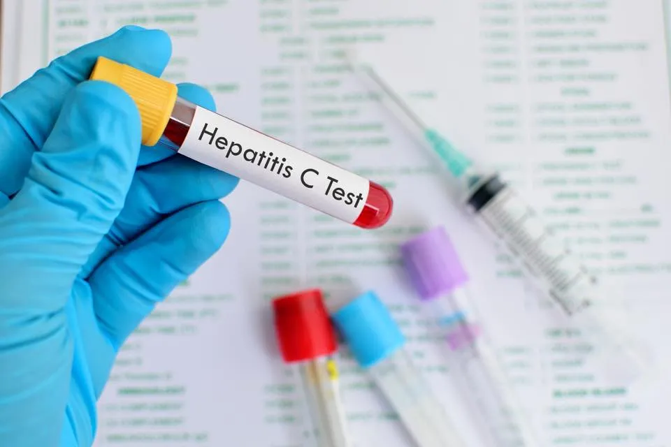 Egyre több a Hepatitis C-vel fertőzött 