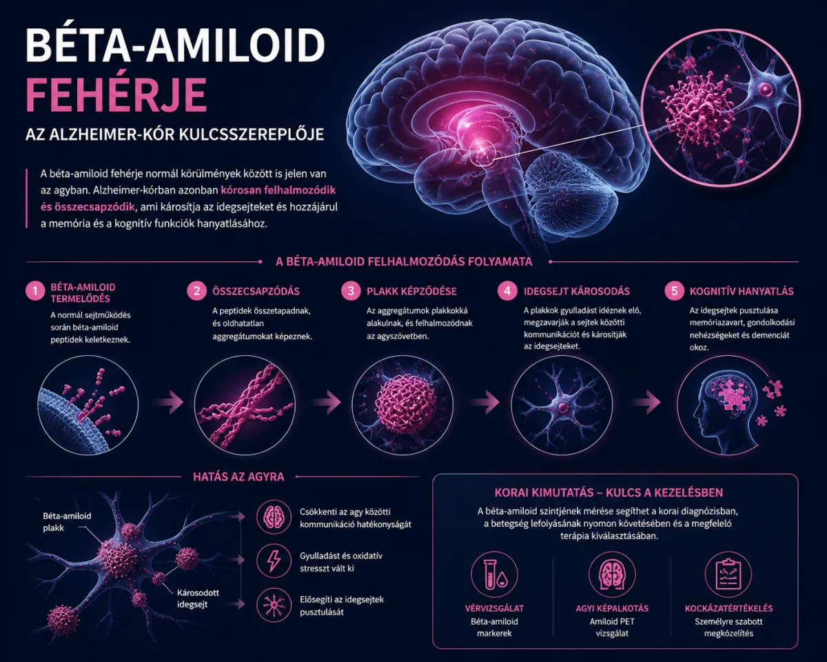 Hogyan kapcsolódik a béta-amiloid az Alzheimer-kórhoz?