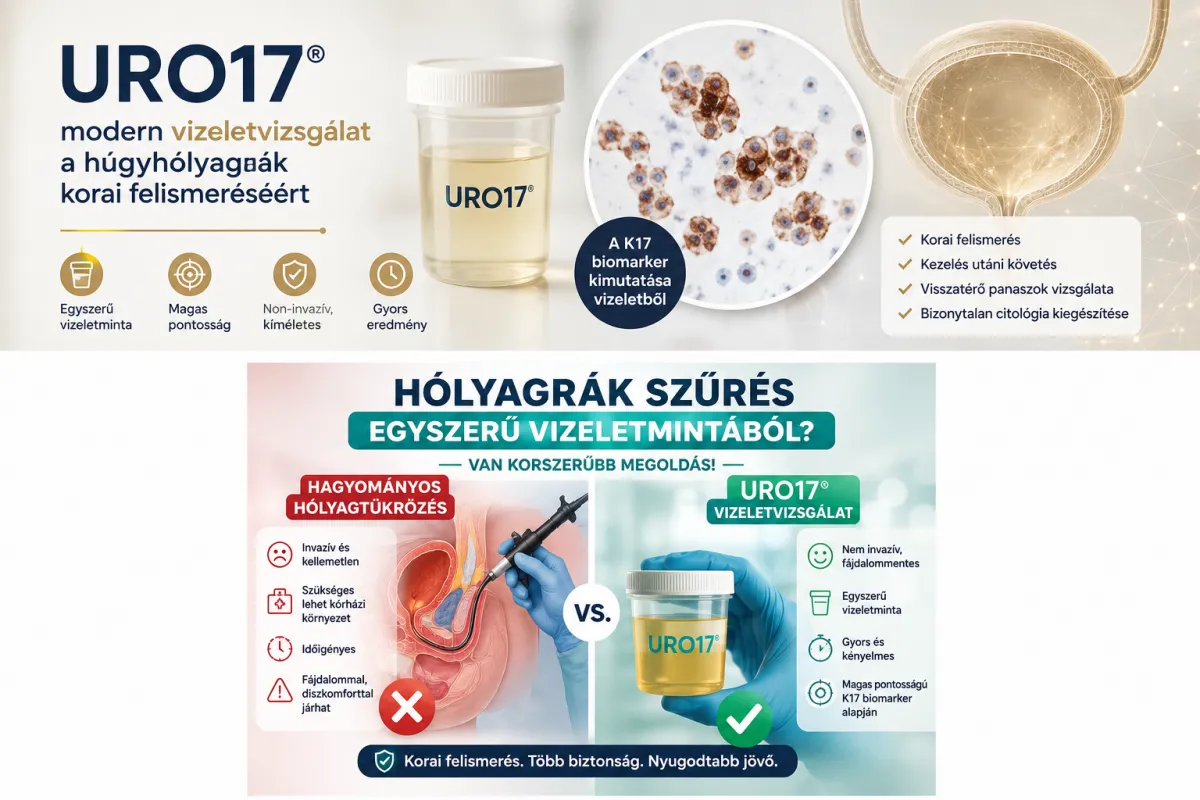 Hólygrák kimutatása vizeletből